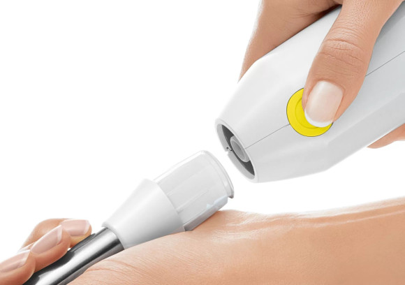 Блендер погружной Bosch MSM66110Y 600Вт белый/желтый